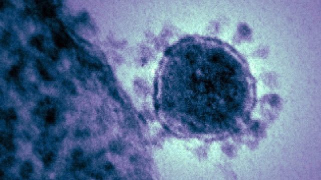 Coronavirus États-Unis