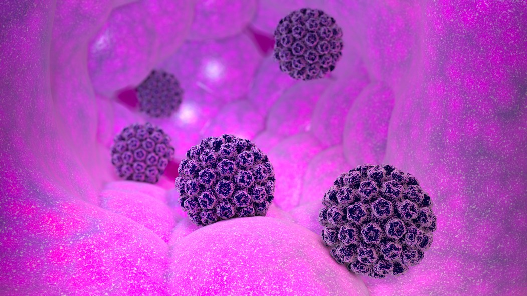 Human papillomavirus infection