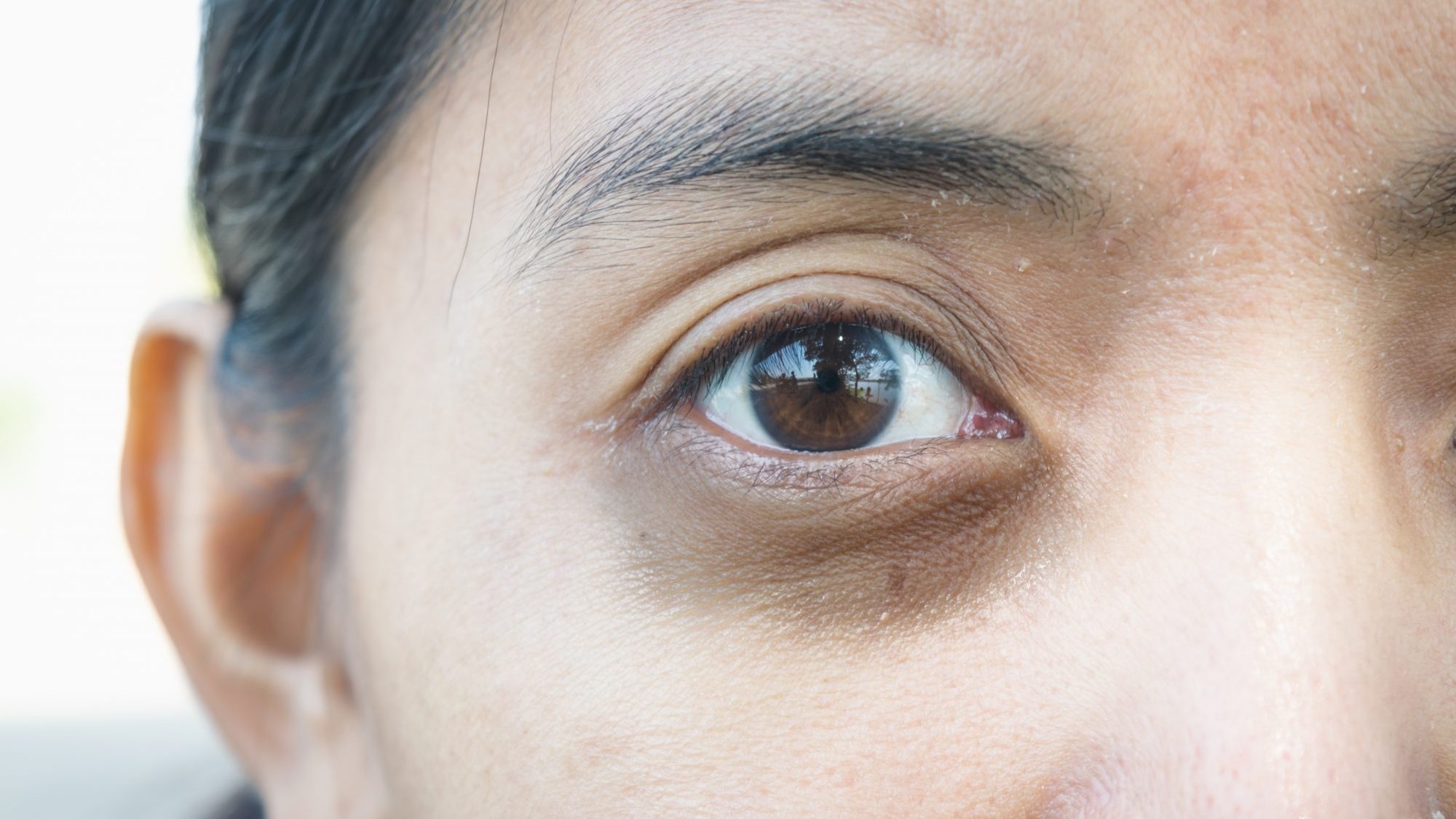 Atténuer les cernes sous les yeux